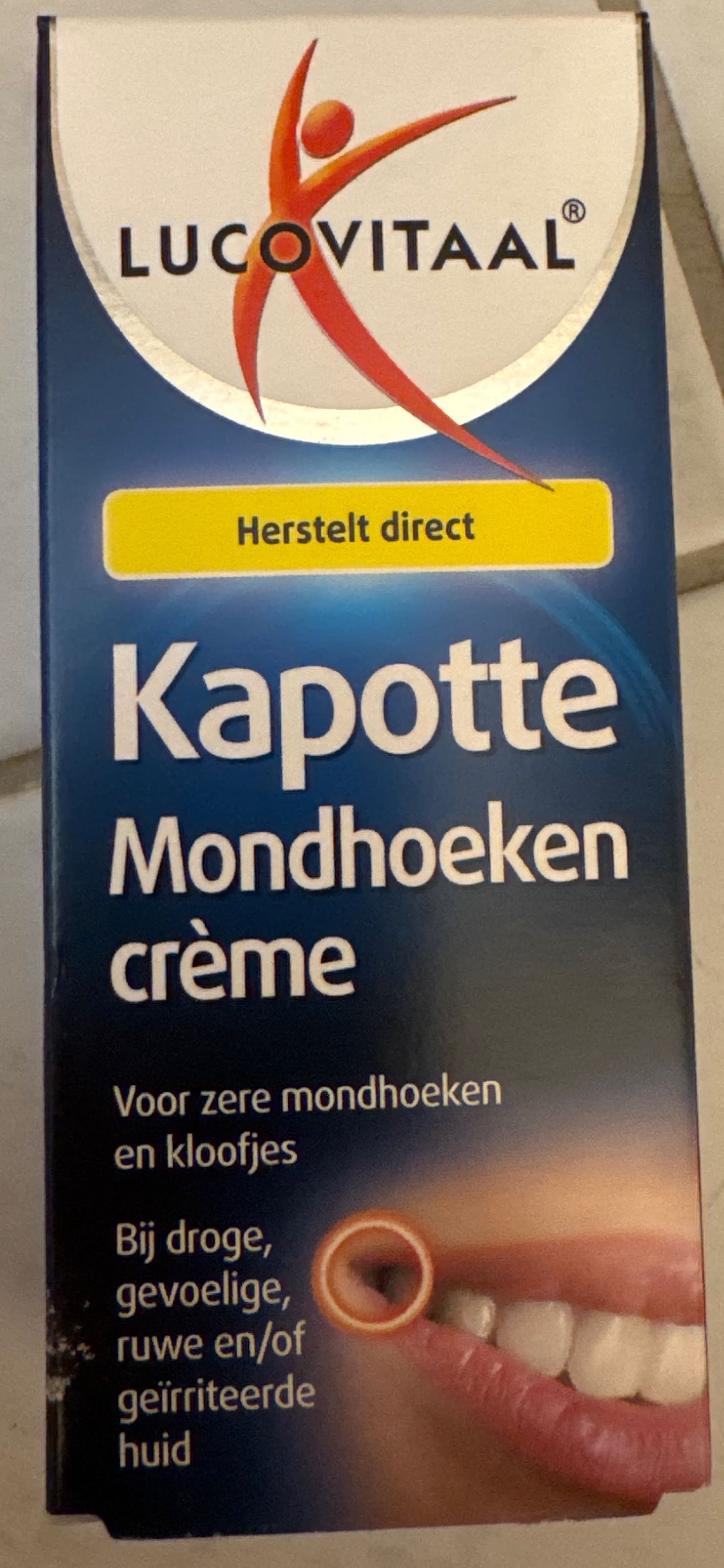 Kapotte mondhoeken
